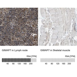 GIMAP7 Antibody, Novus Biologicals 25 &mu;L; Unlabeled:Antibodies, Polyclonal
